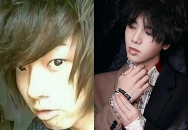 华晨宇,在吴亦凡之事闹得沸沸扬扬之前,华晨宇先是被爆料疑似整容植发