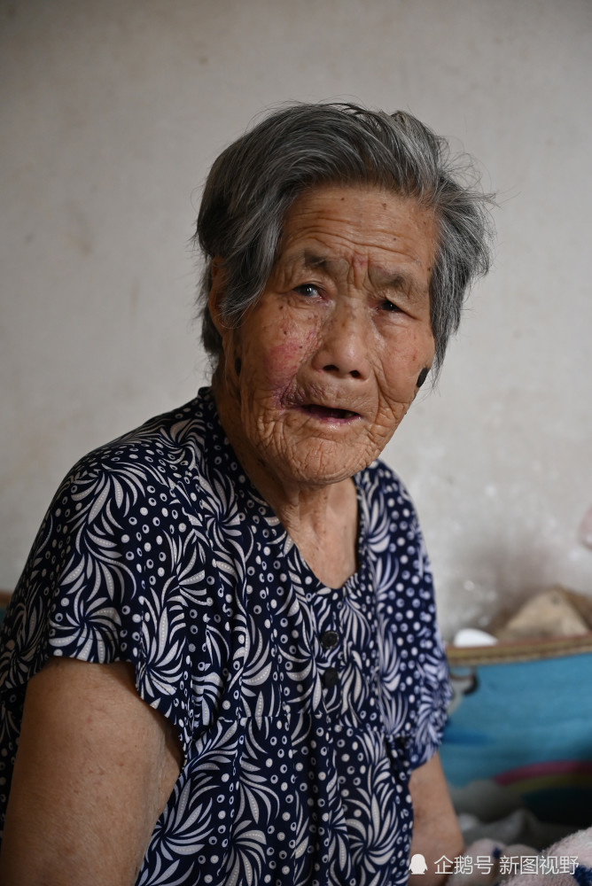 103岁奶奶捏痧图片