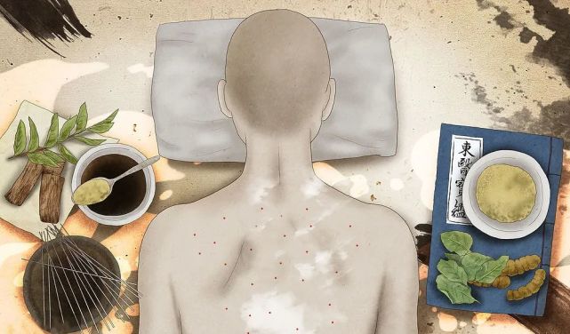 体内有湿,背上长痘,老中医教你"拍一拍"祛除体内湿气!