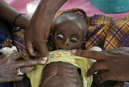 世界欠摄影师一句道歉照片中饿得快昏厥的小男孩最后结局如何了