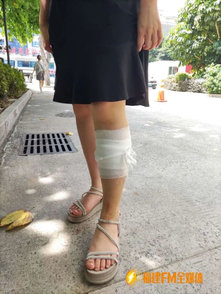 福州一女孩腿被割伤缝了16针这个隐患你小区可能也有
