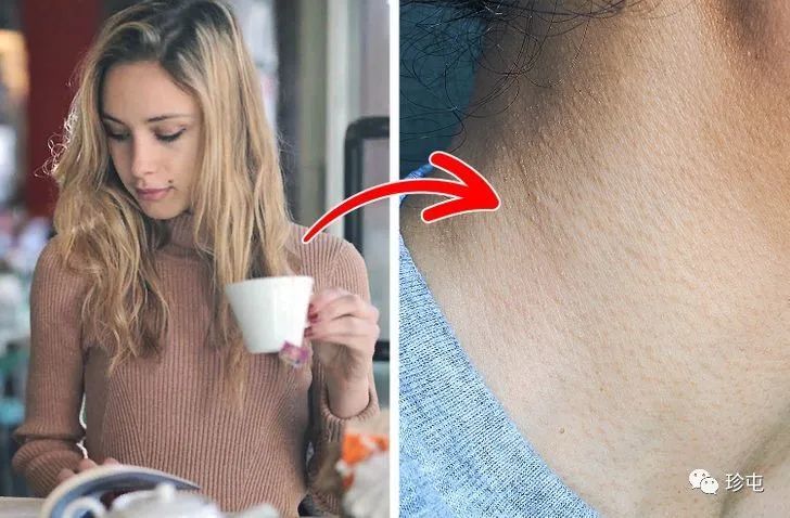 老公皮肤油油起鸡皮(男人皮肤很油是什么原因) 老公皮肤油油起鸡皮(男人皮肤很油是什么原因)