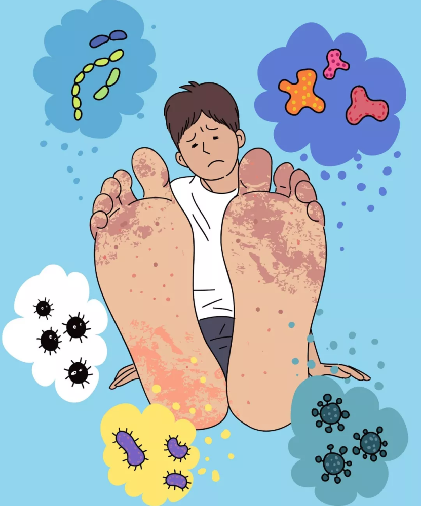 为什么脚气会反复发作呢 反复长脚气是什么原因引起的-十万个为什么