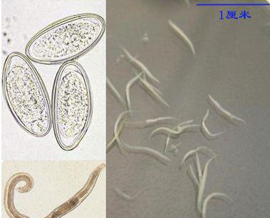 2岁女儿患上蛲虫病得知原因后宝妈直接气得带孩子回娘家