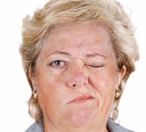 贝尔面瘫不治疗也能自愈真的吗