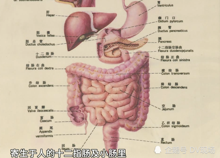 东莞男子腹痛难忍医生从肠道夹出8条活虫