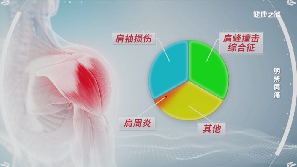 肩痛就是肩周炎嗎?當心越拖越嚴重!|健康之路