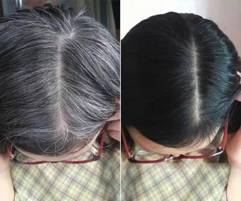 白发越长越多用这个老国货养出乌黑秀发显小10岁