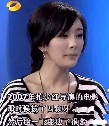 杨幂否认整容，女网红反击其拔牙瘦脸论，称其做了下颌角截骨和颧骨内推