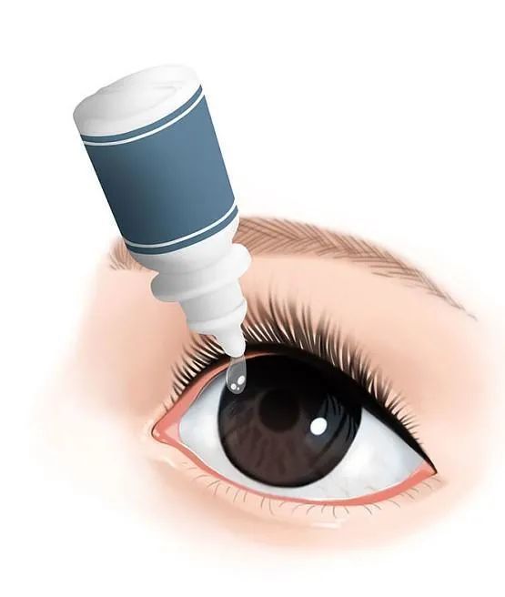 而1%的高浓度阿托品会引起瞳孔放大,畏光等副作用,临床使用仅用于眼底