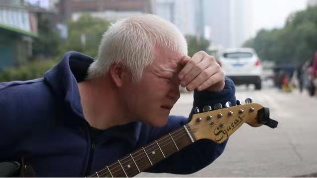 白化病街头艺人阿苏:用音乐"创造美好生活"