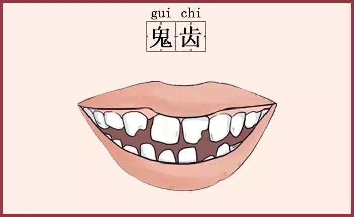 东倒西歪,有缺角,牙缝大,牙齿长得参差不齐,牙齿大小也不一样.