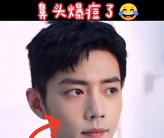 肖战方否认"隐婚生子"!懒理传闻忙着拍广告,脸上的痘却抢了镜