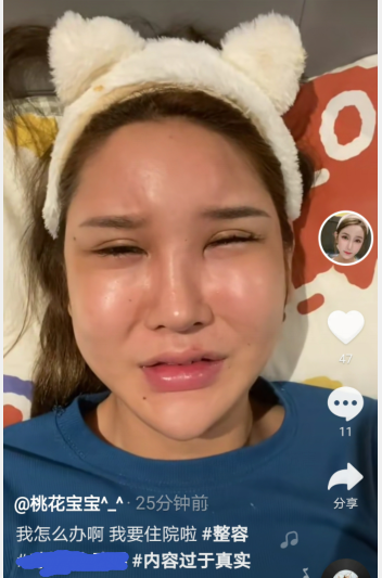女网红整容失败出现严重后遗症,脸肿成馒头眼睛睁不开,崩溃痛哭称自己