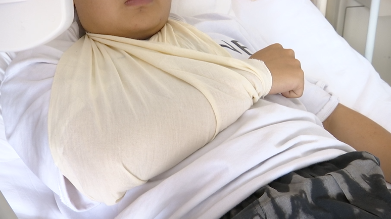 右手被包扎了起来蔡女士的儿子小张躺在病床上记者看到"手已经脱臼,脸