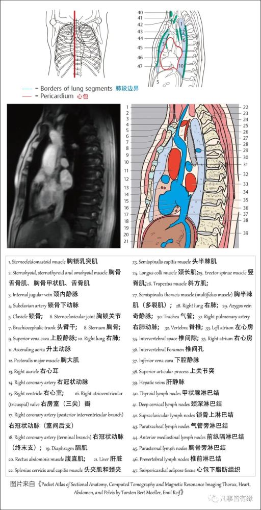 (三)胸部mri冠状位断层解剖:参考资料:textbook of anatomy  upper