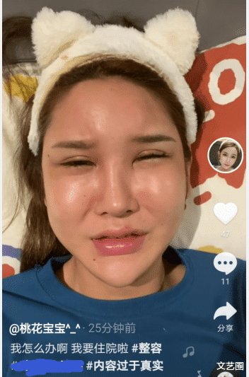 女网红整容失败出现严重后遗症,脸肿成馒头眼睛睁不开,崩溃痛哭称自己