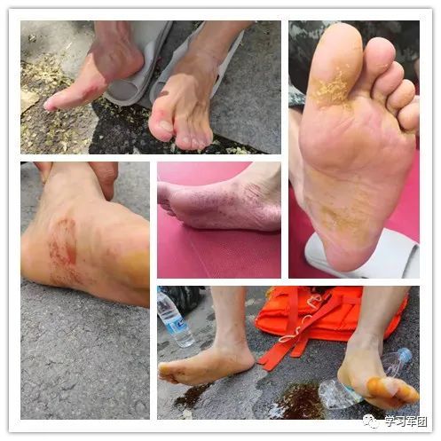 让人看着十分心疼有的官兵脚已泡得发白有的官兵背后长满痱子由于长