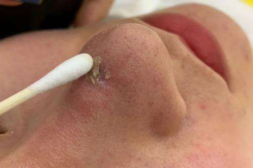 主播do鼻子被"坑" 整形医院承认这是他们的第一台手术