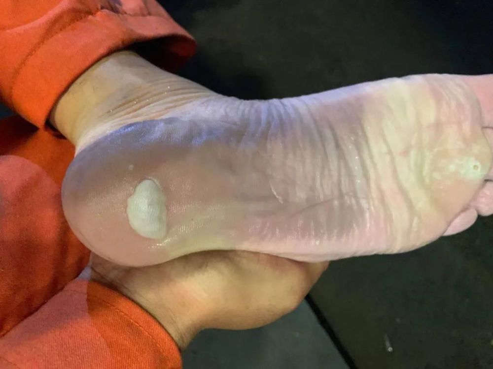 心疼!这是排涝一线消防员的脚