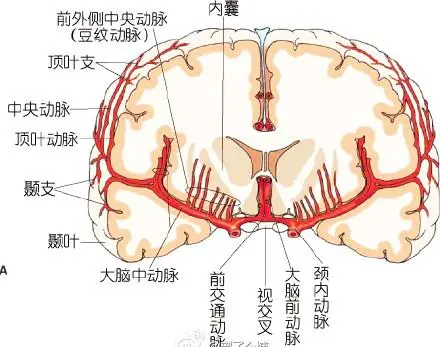 豆纹动脉(直径300～840 μ m)供血区域的缺血性脑血管病临床表现常有