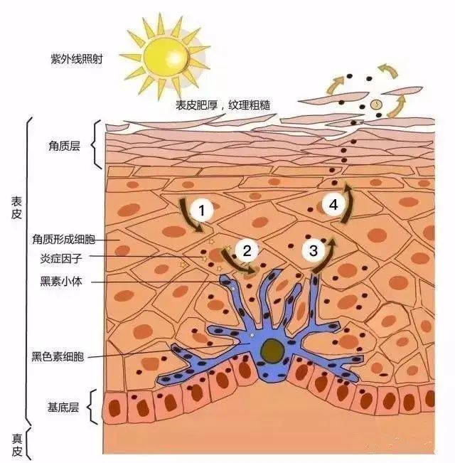 黑色素細胞培植術治療白癜風為什麼效果會這麼好