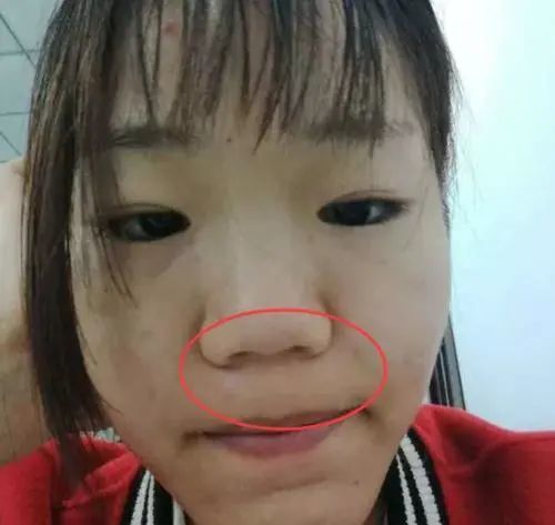 张嘴睡觉会毁容不知道的赶紧来看看