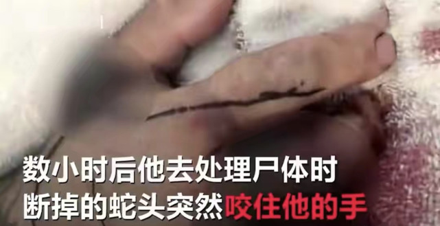 梦见妺妺被蛇咬伤，梦境背后的深层含义与解析