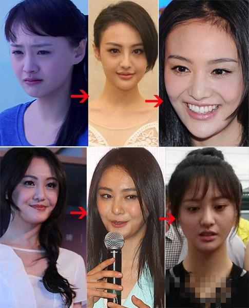 有些女星长的何彼浓矣,华若桃李,却想不开跑去整容,结果失败了
