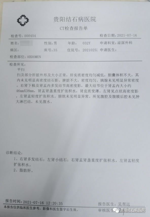 肾结石一直拖会怎么样?他拖出6公分的"巨石,右肾严重受损!