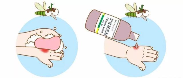 想不到被蚊虫叮咬后这几种药物能快速止痒