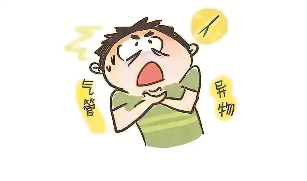 异物卡喉咋办?医生教你海姆立克急救_腾讯新闻