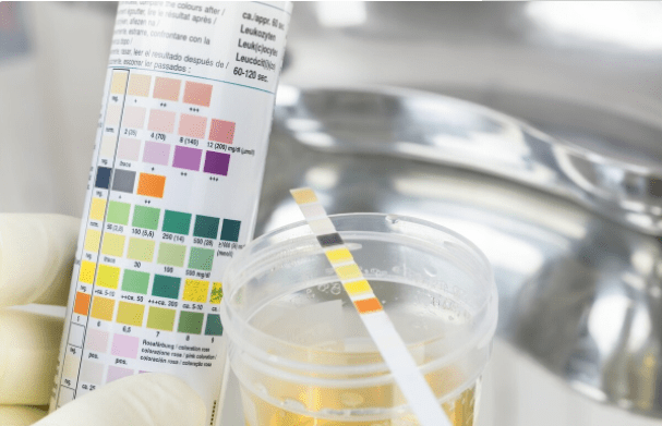 但部分肾友难得不是蛋白尿降不下去,而不是不能维持长期稳定.