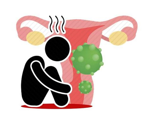 內褲出現一個信號宮頸癌還是月經紊亂醫生說4點區別對照看