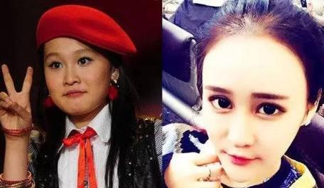 不过,从球球早期与现在照片的来看对比,不难发现,整容痕迹还是挺明显