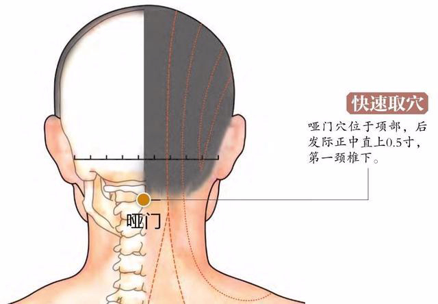 穴位图哑门穴调理音哑头重之特效穴