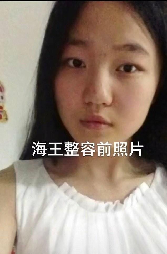 有好事的网友扒出了项思醒在没有成为网红之前的照片,模样与现在天差