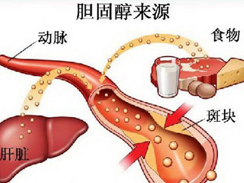 降低胆固醇的10种食物降低_降低胆固醇的10种食物