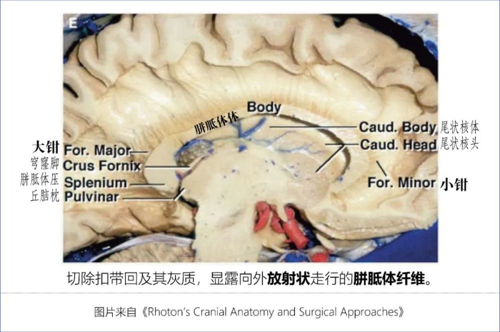 學習筆記|大腦深部解剖之解剖層次篇_騰訊新聞