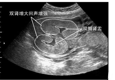 四维彩超单辨男女,准不准?
