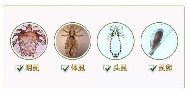 一般人体上寄生的虱子有体虱,头虱和阴虱,很多朋友经历的应该是头虱!