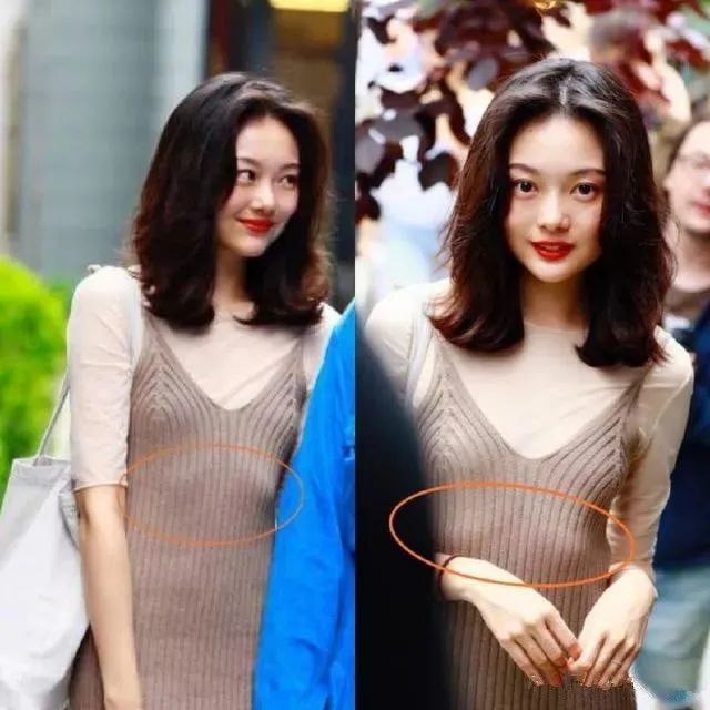 你以为的腹肌也许只是肋骨外翻
