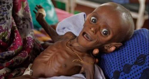 非洲大饥荒1年活活饿死1600万人食草根啃树皮宛如人间地狱