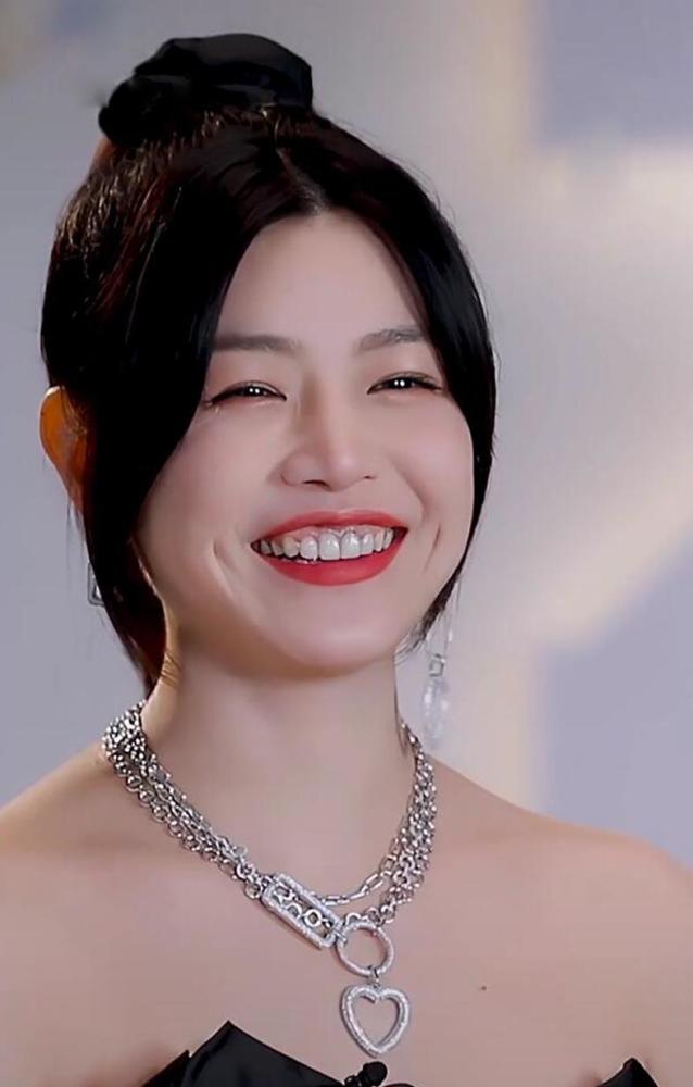 "烤瓷牙"成衡量明星红不红的标准?