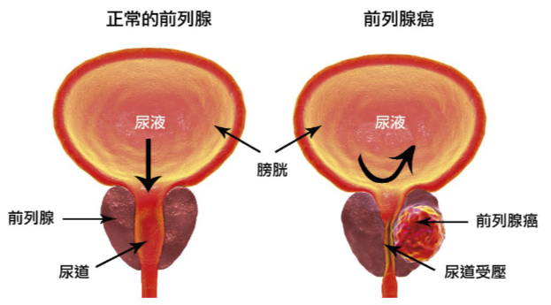 油菜花粉治疗前列腺炎研究_油菜花粉前列腺炎克星_油菜花粉前列腺炎用量