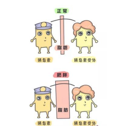 【漫画解说】形象诠释肥胖&多囊的真凶—胰岛素抵抗!