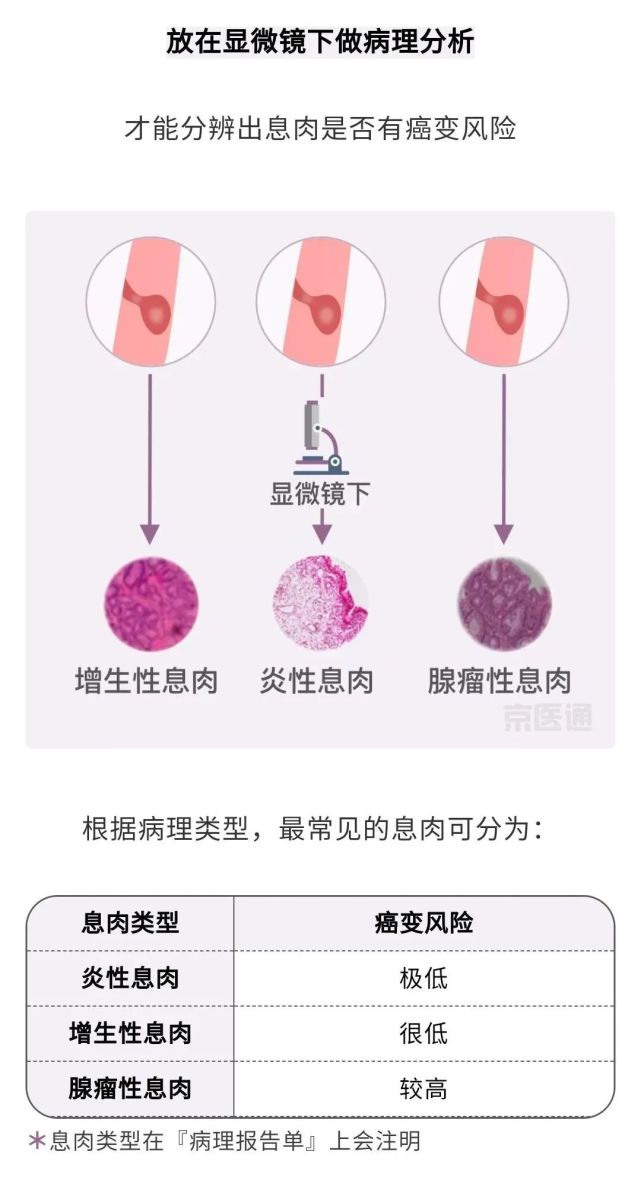 结节,息肉,囊肿是癌症先兆吗?北肿专家们说出了真相!-腾讯新闻