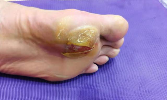 腾讯内容开放平台