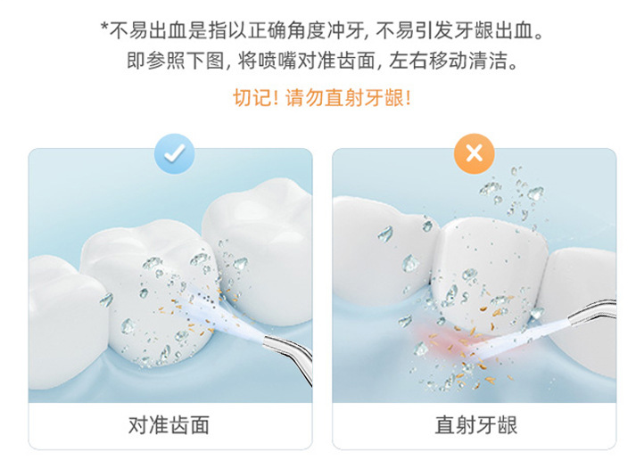 沿着牙龈,牙缝冲洗,不仅可以将表面牙垢清除,每天使用防止牙结石生成