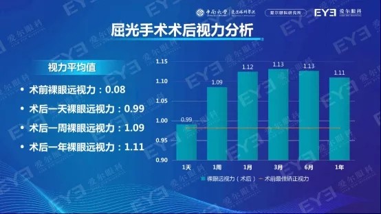 兰州爱尔：不同的近视手术术式怎么选？要选择适合自己的！(图2)